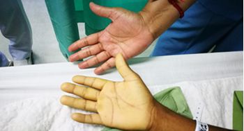 Anemias