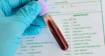 Interpretação de Hemograma