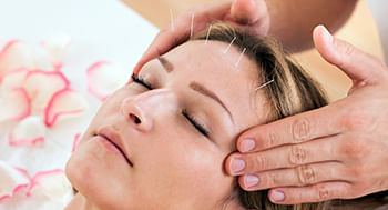 Acupuntura Estética