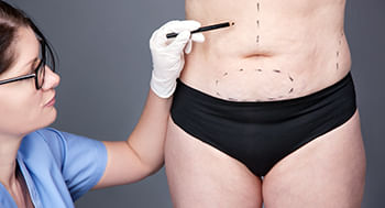 Abdominoplastia: Pré e Pós-Operatório