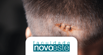 TCC em questões de traumas e estressores